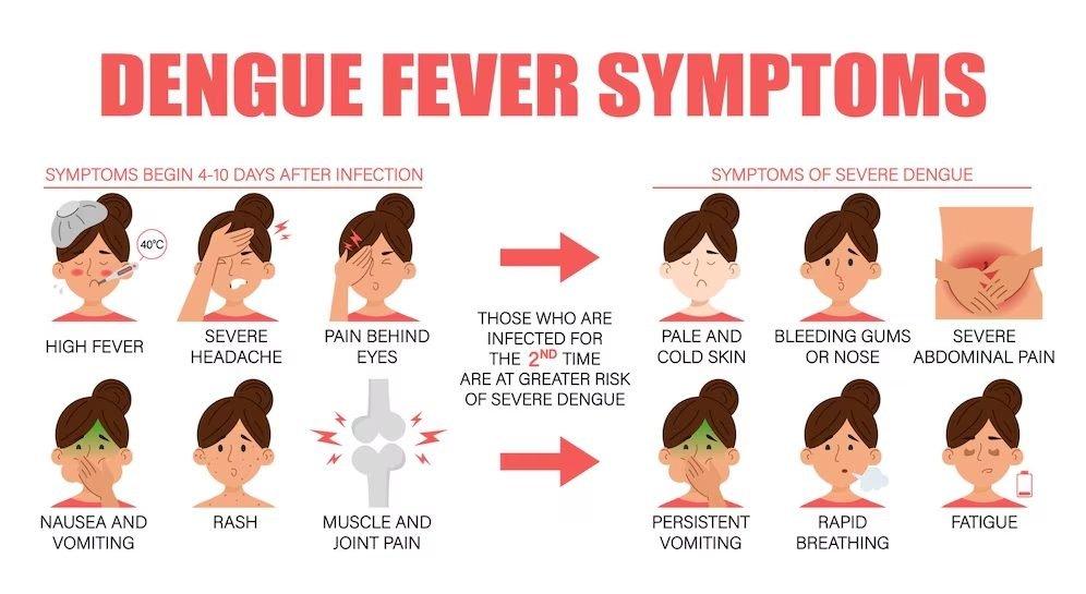 symptoms-dengue-fever-vector-isolated_226203-546 Dengue sign